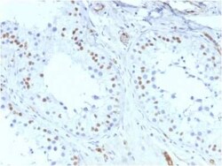 WT1 Antibody (rWT1/857), Novus Biologicals:Antibodies:Primary Antibodies