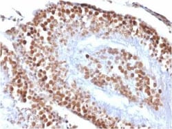 WT1 Antibody (rWT1/857), Novus Biologicals:Antibodies:Primary Antibodies