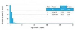 WT1 Antibody (rWT1/857), Novus Biologicals:Antibodies:Primary Antibodies