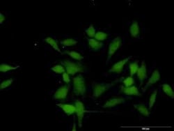 WTIP Antibody, Novus Biologicals 0.05 mg | Buy Online | Novus Biologicals | Fisher Scientific