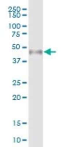 WTIP Antibody, Novus Biologicals 0.05 mg | Buy Online | Novus Biologicals | Fisher Scientific