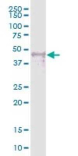 WTIP Antibody, Novus Biologicals 0.05 mg | Buy Online | Novus Biologicals | Fisher Scientific