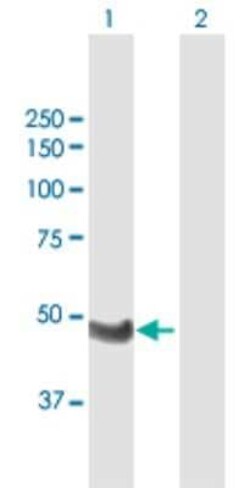 WTIP Antibody, Novus Biologicals 0.05 mg | Buy Online | Novus Biologicals | Fisher Scientific