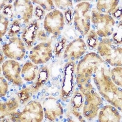 WWC2 Rabbit anti-Human, Mouse, Rat, Polyclonal, Novus Biologicals:Antibodies:Primary