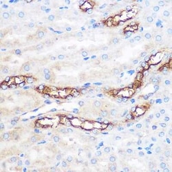 WWC2 Rabbit anti-Human, Mouse, Rat, Polyclonal, Novus Biologicals:Antibodies:Primary