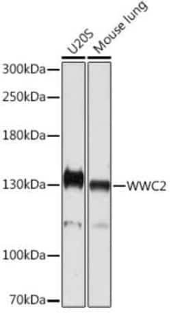 WWC2 Rabbit anti-Human, Mouse, Rat, Polyclonal, Novus Biologicals:Antibodies:Primary