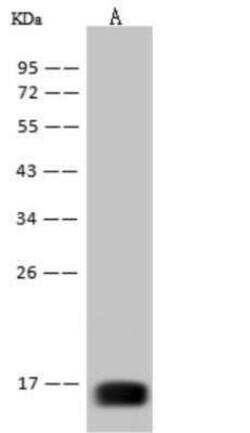 West Nile Virus Envelope Antibody (15) - (Domain III), Novus Biologicals:Antibodies:Primary