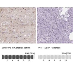 Wnt-10b Antibody, Novus Biologicals:Antibodies:Primary Antibodies