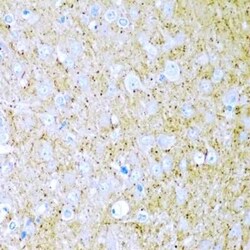 Wnt-2 Antibody - BSA Free, Novus Biologicals 0.02 mL; Unconjugated:Antibodies,