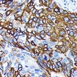 Wnt-5a Rabbit anti-Human, Clone: 3P2E8, Novus Biologicals 20 &mu;g; Unconjugated:Antibodies,