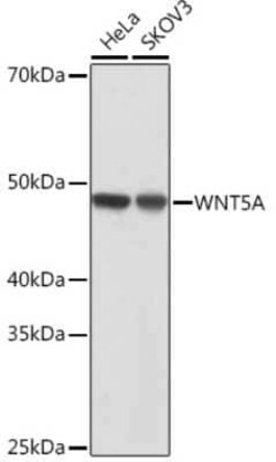 Wnt-5a Rabbit anti-Human, Clone: 3P2E8, Novus Biologicals 20 &mu;g; Unconjugated:Antibodies,