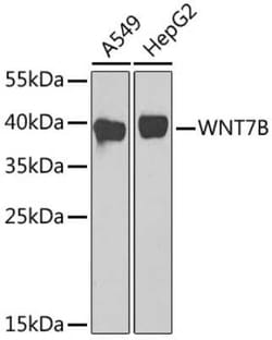 Wnt-7b Antibody - BSA Free, Novus Biologicals 0.1 mL, Unconjugated:Antibodies,
