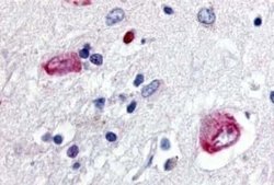 Wnt-8a Antibody, Novus Biologicals 50 &mu;g; Unconjugated:Antibodies, Polyclonal