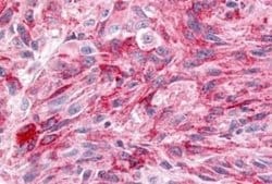 Wnt-8a Antibody, Novus Biologicals 50 &mu;g; Unconjugated:Antibodies, Polyclonal
