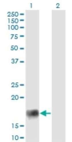 XAGE2 Antibody (4C4), Novus Biologicals 0.1 mg | Buy Online | Novus Biologicals | Fisher Scientific