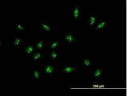 XAGE2 Antibody, Novus Biologicals 0.05 mg, Unconjugated:Antibodies, Polyclonal