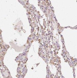 XAGE2 Antibody, Novus Biologicals:Antibodies:Primary Antibodies