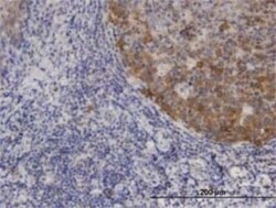 XCL1/Lymphotactin Antibody (1E1), Novus Biologicals 0.1 mg | Buy Online | Novus Biologicals | Fisher Scientific