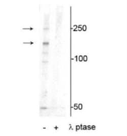 XIRP1 Rabbit anti-Mouse, Polyclonal, Novus Biologicals 100 &mu;g; Unconjugated:Antibodies,