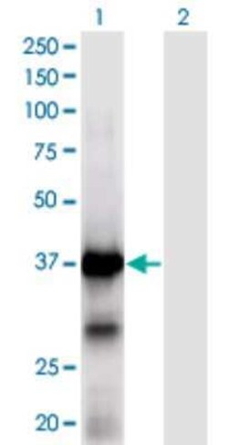 XPA Antibody (2E4), Novus Biologicals 0.1 mg | Buy Online | Novus Biologicals | Fisher Scientific