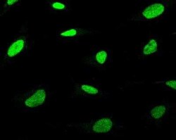 XPC Antibody, Novus Biologicals 100 &mu;g; Unconjugated:Antibodies, Polyclonal