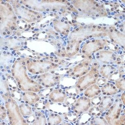XPD Rabbit anti-Human, Mouse, Rat, Clone: 6T9K6, Novus Biologicals:Antibodies:Primary