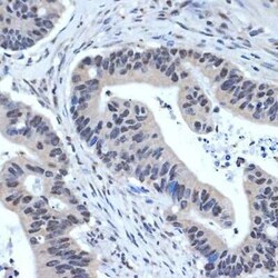 XPD Rabbit anti-Human, Mouse, Rat, Clone: 6T9K6, Novus Biologicals:Antibodies:Primary