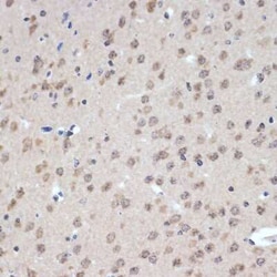 XPD Rabbit anti-Human, Mouse, Rat, Clone: 6T9K6, Novus Biologicals:Antibodies:Primary