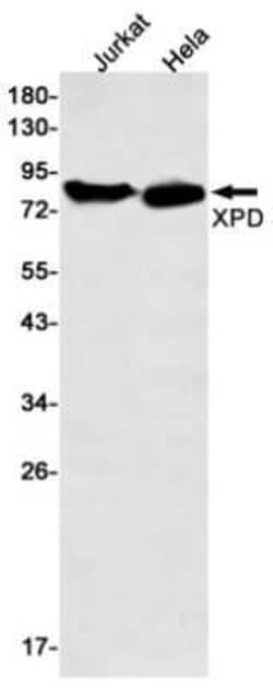 XPD Rabbit anti-Human, Clone: S08-2I3, Novus Biologicals 100 &mu;g; Unconjugated:Antibodies,