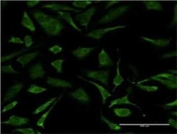XPD Antibody (S3), Novus Biologicals 0.1 mg; Unconjugated:Antibodies, Monoclonal