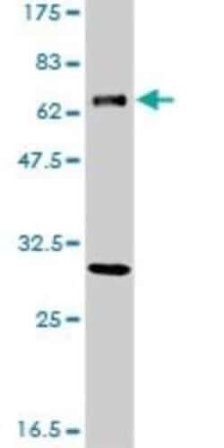 XPD Antibody (S3), Novus Biologicals 0.1 mg; Unconjugated:Antibodies, Monoclonal