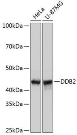XPE/DDB2 Rabbit anti-Human, Mouse, Clone: 4Y2G5, Novus Biologicals 100