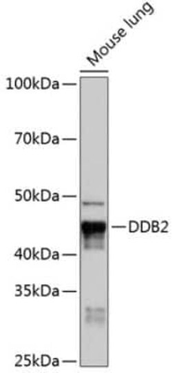 XPE/DDB2 Rabbit anti-Human, Mouse, Clone: 4Y2G5, Novus Biologicals 100