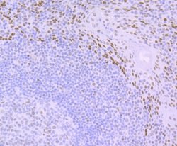 XPE/DDB2 Rabbit anti-Human, Clone: JE16-41, Novus Biologicals 100 &mu;l;