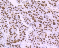 XPE/DDB2 Rabbit anti-Human, Clone: JE16-41, Novus Biologicals 100 &mu;l;