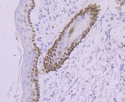 XPE/DDB2 Rabbit anti-Human, Clone: JE16-41, Novus Biologicals 100 &mu;l;