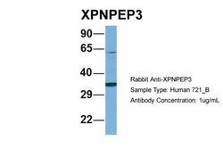 XPNPEP3 Rabbit anti-Human, Polyclonal, Novus Biologicals 0.1 mL | Buy Online | Novus Biologicals | Fisher Scientific