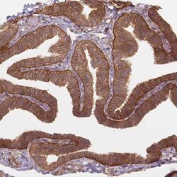 XPR1 Antibody, Novus Biologicals:Antibodies:Primary Antibodies