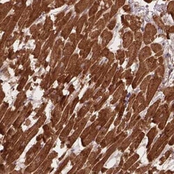 XPR1 Antibody, Novus Biologicals:Antibodies:Primary Antibodies