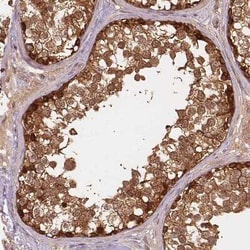 XPR1 Antibody, Novus Biologicals:Antibodies:Primary Antibodies