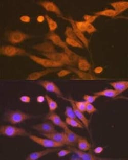 Xanthine Oxidase Rabbit anti-Human, Mouse, Rat, Clone: 0M8E7, Novus Biologicals