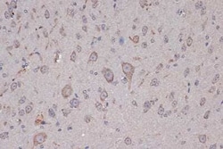 Xanthine Oxidase Rabbit anti-Human, Mouse, Rat, Clone: 0M8E7, Novus Biologicals