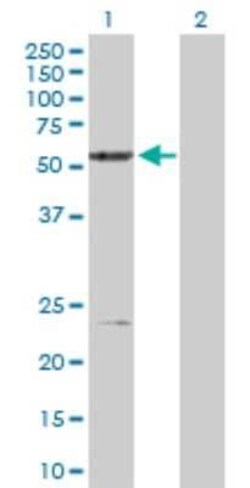 Novus Biologicals Xrn1 Antibody, Novus Biologicals 0.1 mg | Buy Online | Novus Biologicals&trade; | Fisher Scientific