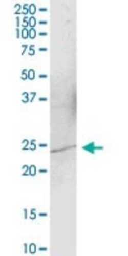YAF2 Antibody, Novus Biologicals 0.05 mg | Buy Online | Novus Biologicals | Fisher Scientific