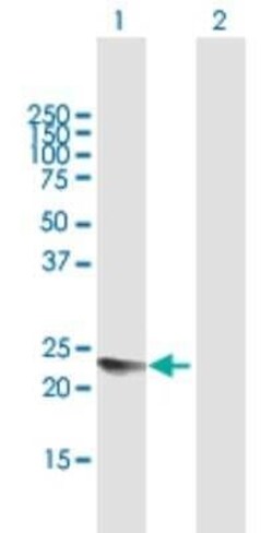 YAF2 Antibody, Novus Biologicals 0.05 mg | Buy Online | Novus Biologicals | Fisher Scientific