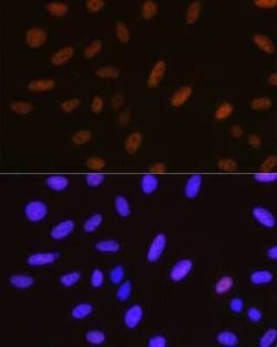 YAP1 Rabbit anti-Human, Mouse, Clone: 6L3F2, Novus Biologicals 20 &mu;g | Buy Online | Bio-Techne | Fisher Scientific