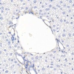 YAP1 Rabbit anti-Human, Mouse, Clone: 6L3F2, Novus Biologicals 20 &mu;g | Buy Online | Bio-Techne | Fisher Scientific