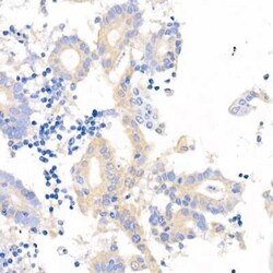 YAP1 Rabbit anti-Human, Mouse, Clone: 6L3F2, Novus Biologicals 20 &mu;g | Buy Online | Bio-Techne | Fisher Scientific