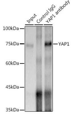 YAP1 Rabbit anti-Human, Mouse, Clone: 6L3F2, Novus Biologicals 20 &mu;g | Buy Online | Bio-Techne | Fisher Scientific