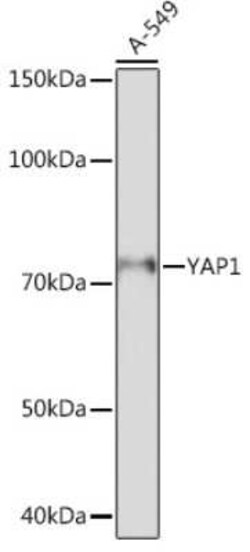 YAP1 Rabbit anti-Human, Mouse, Clone: 6L3F2, Novus Biologicals 20 &mu;g | Buy Online | Bio-Techne | Fisher Scientific